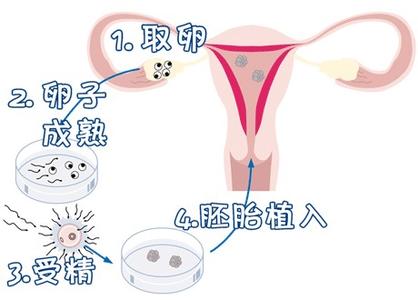 正规同性代孕咨询包生儿子